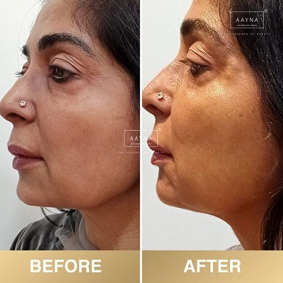 client-before-after-img