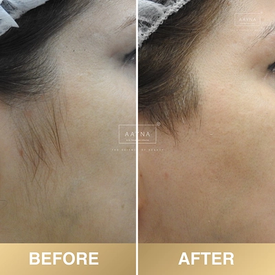 client-before-after-img