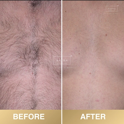client-before-after-img