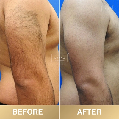 client-before-after-img
