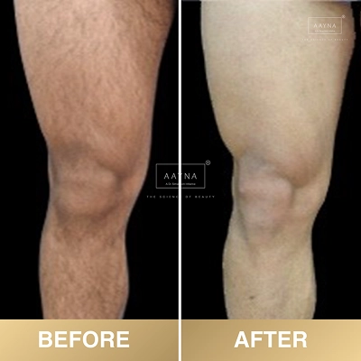 client-before-after-img