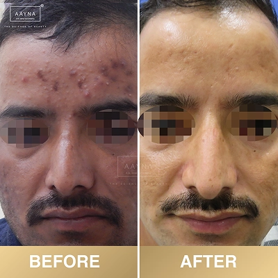 client-before-after-img