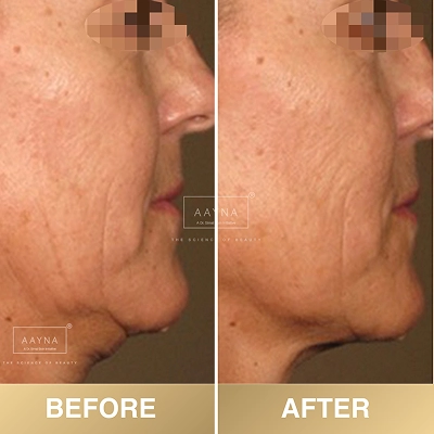 client-before-after-img