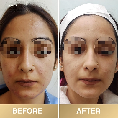 client-before-after-img