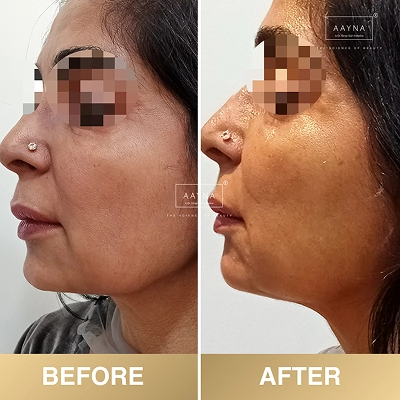 client-before-after-img