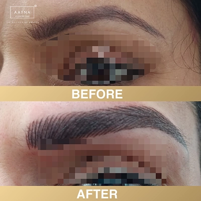 client-before-after-img