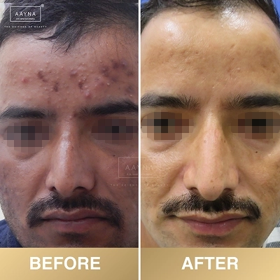 client-before-after-img