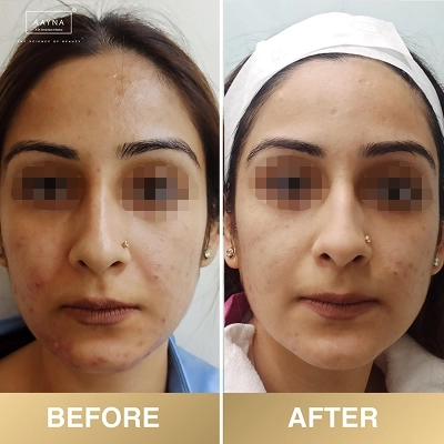 client-before-after-img