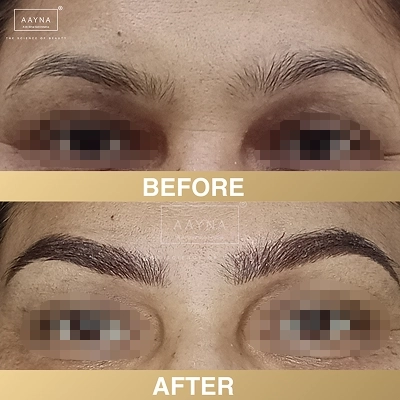 client-before-after-img