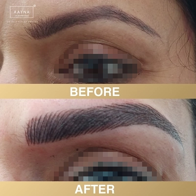 client-before-after-img