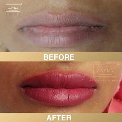 client-before-after-img