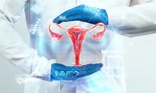 Cervical Cancer Care