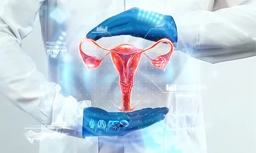 Endometrial Cancer Care