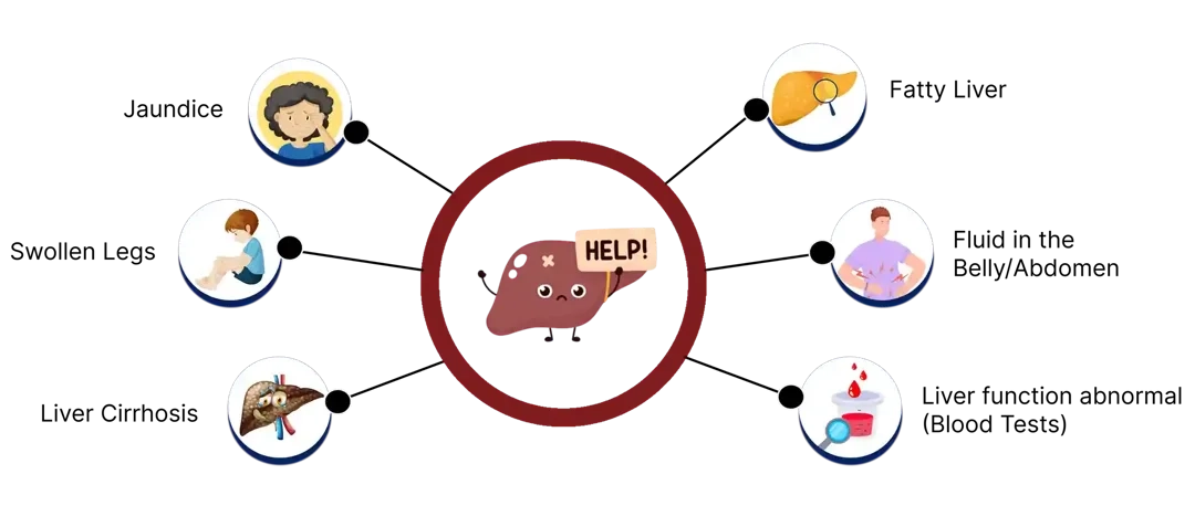  Signs of Liver Damage