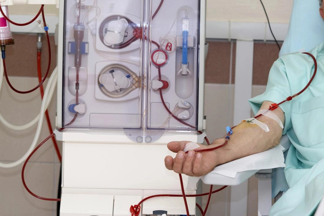 Patient receiving dialysis treatment with medical equipment in use